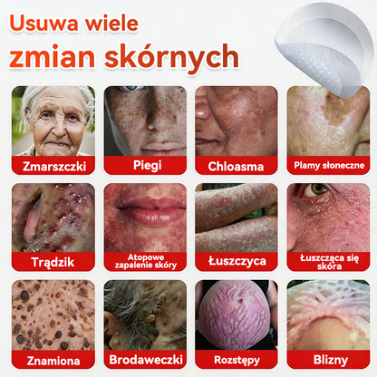 ✅ PuraCure® Plastry do usuwania brodawek i znamion z mikronakłuciami roślinnymi