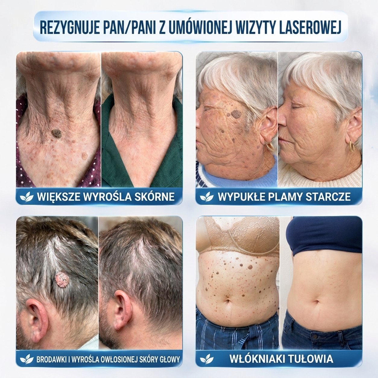 PuraCure® 👩‍⚕️ Pisak do Usuwania Zmian Skórnych i Przebarwień w 7 Dni – Bezbolesna Aplikacja, Bez Powstawania Blizn, Profesjonalny Aplikator Rollerball