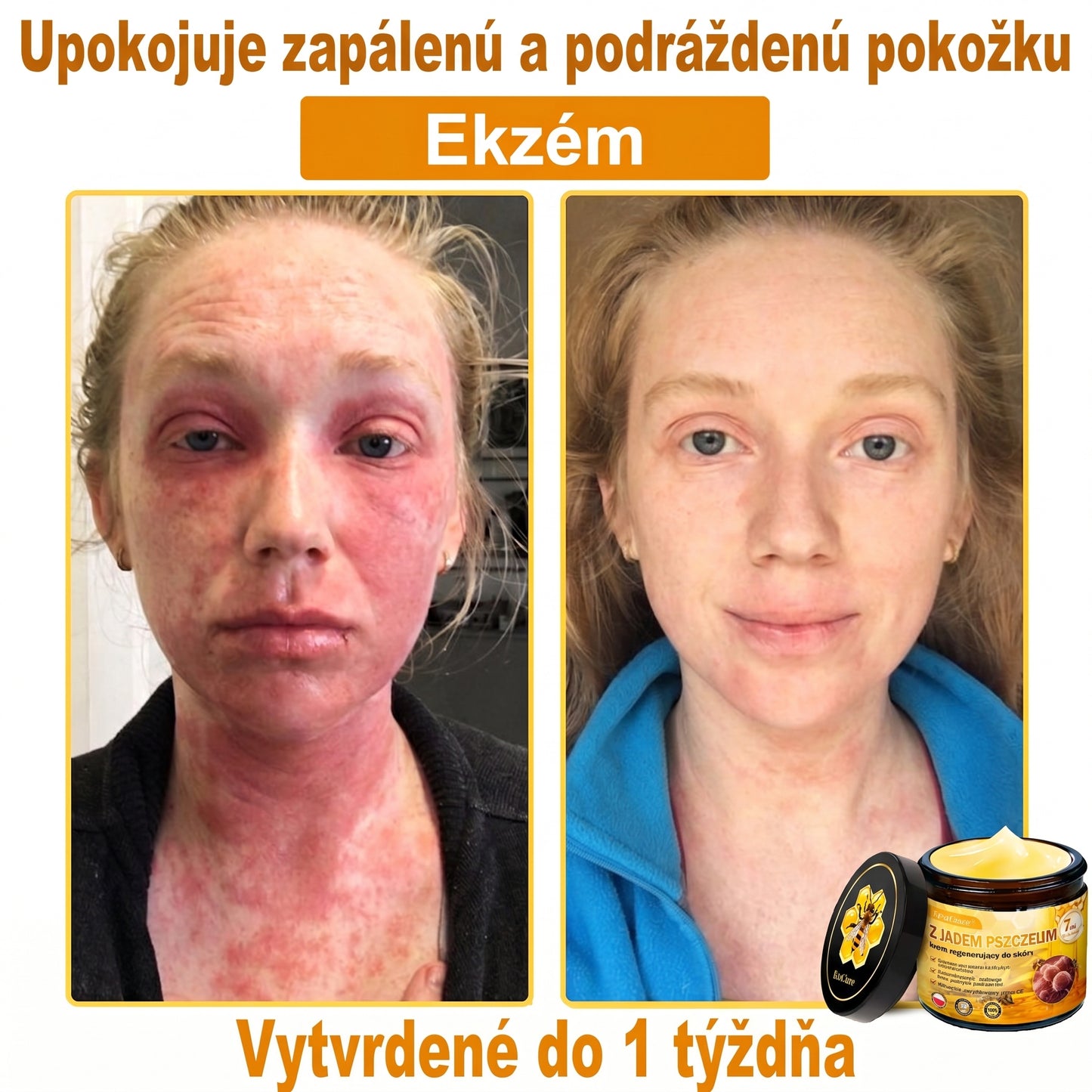 🥇🐝PuraCure® Jad Pszczeli Regeneracja Skóry Krem(👨‍⚕‍CE zatwierdzone)👍✅