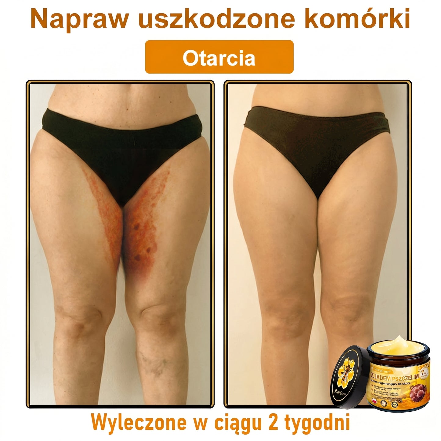 🥇🐝PuraCure® Jad Pszczeli Regeneracja Skóry Krem(👨‍⚕‍CE zatwierdzone)👍✅