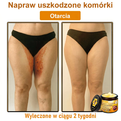 🥇🐝PuraCure® Jad Pszczeli Regeneracja Skóry Krem(👨‍⚕‍CE zatwierdzone)👍✅
