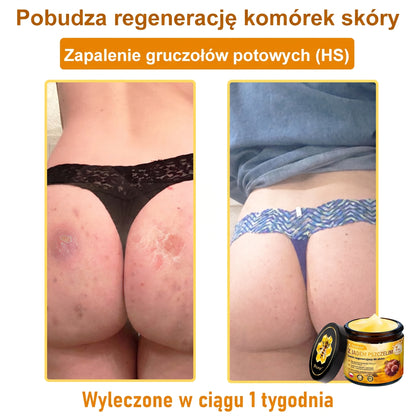 🥇🐝PuraCure® Jad Pszczeli Regeneracja Skóry Krem(👨‍⚕‍CE zatwierdzone)👍✅