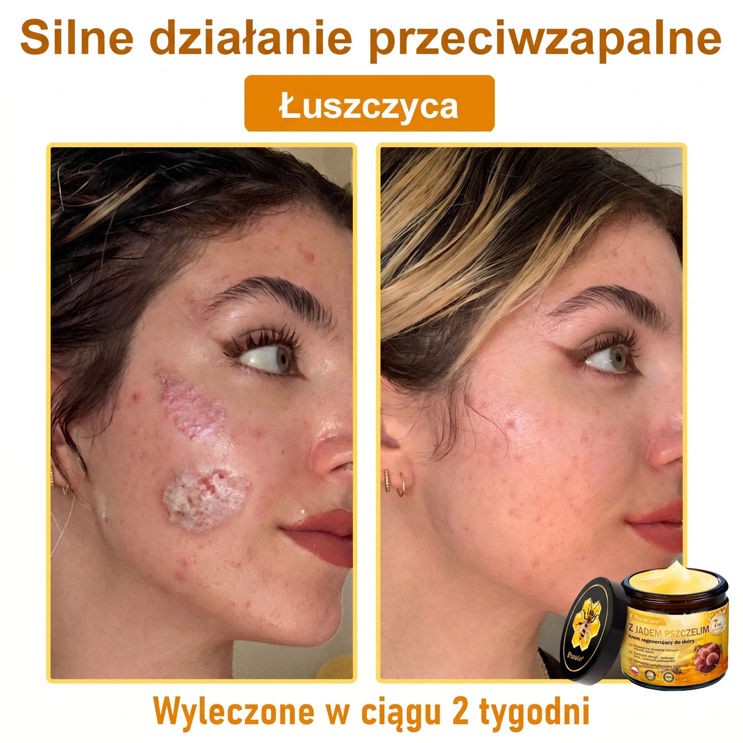 🥇🐝PuraCure® Jad Pszczeli Regeneracja Skóry Krem(👨‍⚕‍CE zatwierdzone)👍✅