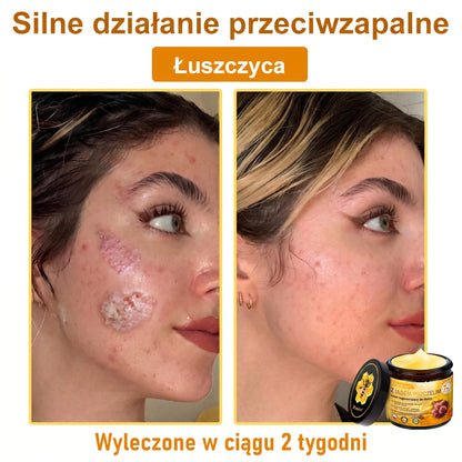 🥇🐝PuraCure® Jad Pszczeli Regeneracja Skóry Krem(👨‍⚕‍CE zatwierdzone)👍✅